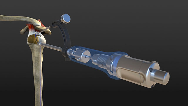Animazione di attrezzature medicali chirurgiche in grafica 3D